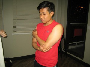 Forearm muscle strain